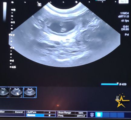 Portée 2025: Gestation Confirmée